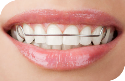 All-Ceramic Crowns