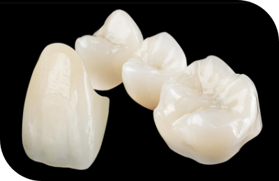 All-Ceramic Crowns