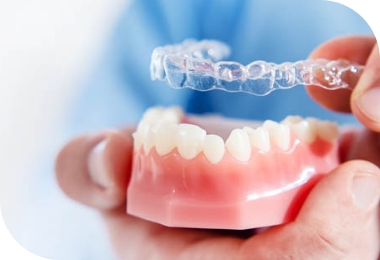 Features of Deep Bite