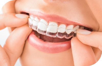 Invisalign