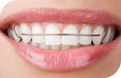 Orthodontic Retainers