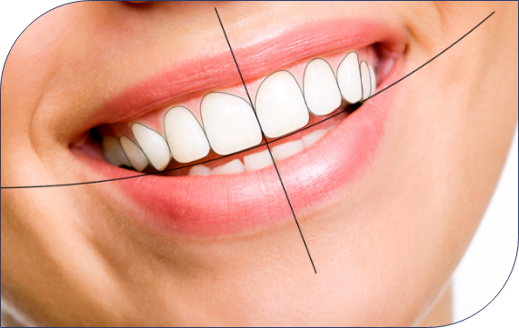 smile-designing