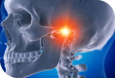Features of Deep Bite