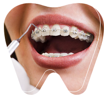 Orthodontics
